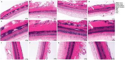 Transcriptome Analysis of Choroid and Retina From Tree Shrew With Choroidal Neovascularization Reveals Key Signaling Moieties